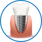 Titanium